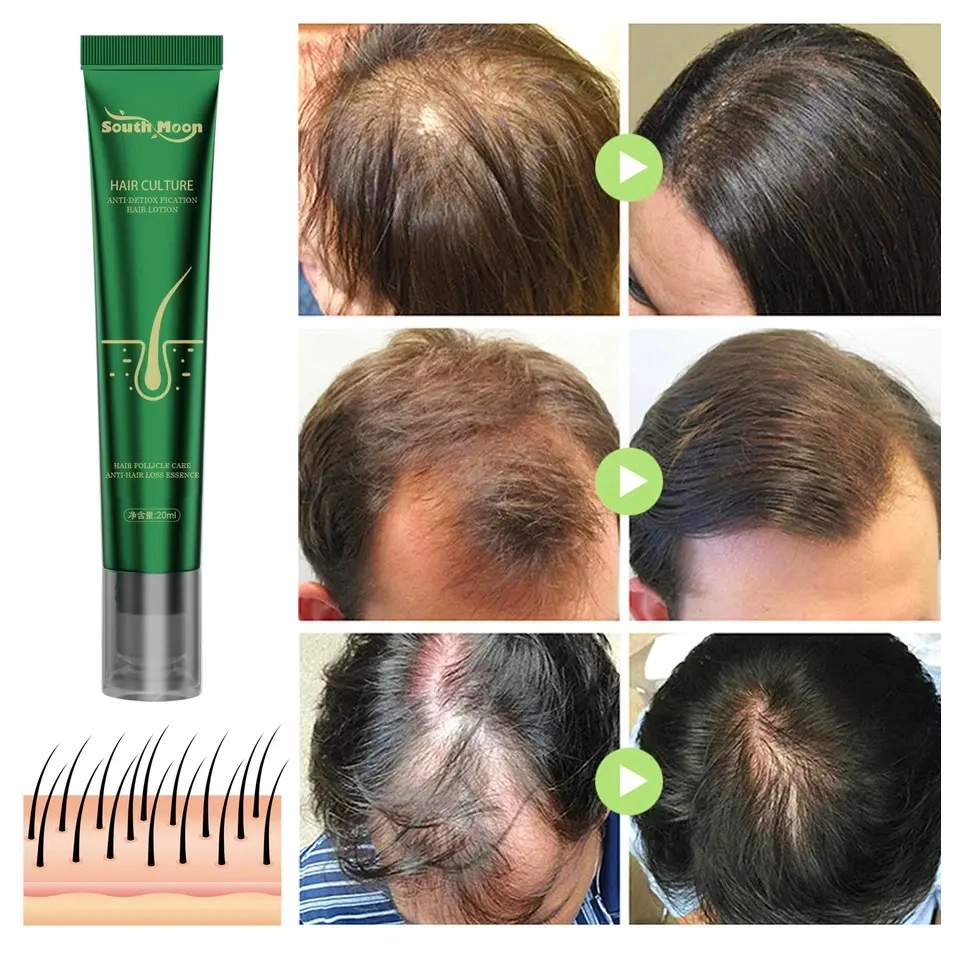 hair regrowth serum hair regrowth serum