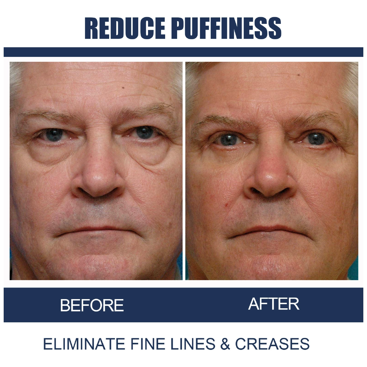 eye cream anti aging كريم تقليل انتفاخات تحت العين الأصلي